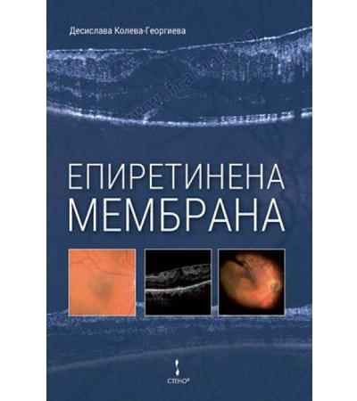 ЕПИРЕТИНЕНА МЕМБРАНА - ДЕСИСЛАВА КОЛЕВА - ГЕОРГИЕВА
